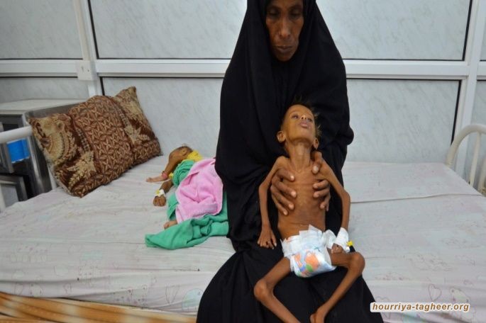 الأمم المتحدة: مصرع طفل كل 10 دقائق في اليمن