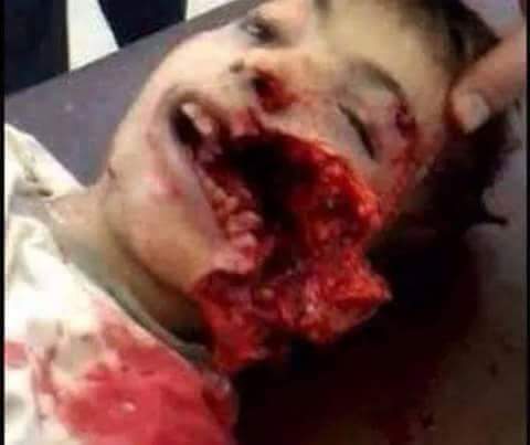 تقرير أممي سرّي: التحالف السعودي قتل مئات الأطفال
