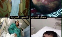 مملكة التعذيب.. آل سعود يواصلون انتهاكات حقوق الإنسان رغم الصرخات الدولية