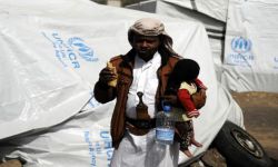 خطر كورونا مضاعف في اليمن بعد 5 أعوام من حرب آل سعود