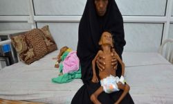 الأمم المتحدة: مصرع طفل كل 10 دقائق في اليمن