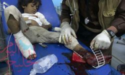 مجزرة الجوف، عندما تقتل الأمم المتحدة اليمنيين بصمتها