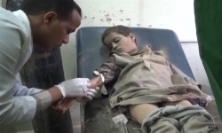 كيف تضع السعودية حدا لمعاناة المصابين اليمنيين؟