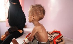 اليونيسيف: الحرب تمحو مكاسب صحية في اليمن وأطفال كثيرون يتضورون جوعا