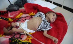 لوس أنجلوس تايمز تطالب السعودية بوقف قصف اليمنيين