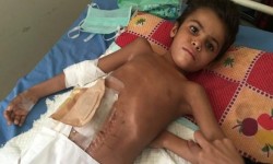 “نيويورك تايمز” الموت البطيء في اليمن.. هذه هي أفظع أزمة إنسانية في العالم