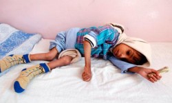 أطفال اليمن… أدمى ضحايا الحرب
