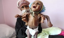 الأمم المتحدة: 14 مليون يمني معرضون لخطر المجاعة في العام الحالي