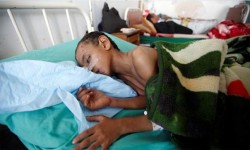 الأمم المتحدة تدقّ ناقوس الخطر: انهيار القطاع الصحي في اليمن والمجاعة قد تضرب البلاد