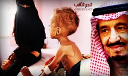 الكارثة الإنسانية في اليمن تدق ناقوس الخطر للمجاميع الإسلامية والأممية