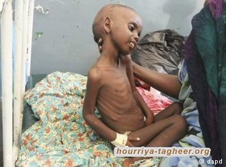 العالم غاضب من أسلحة آل سعود؛ حقيقة أم مجرد ورقة ضغط؟