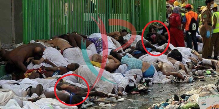 اثار حروق مجهولة السبب على اجساد ضحايا تدافع منى