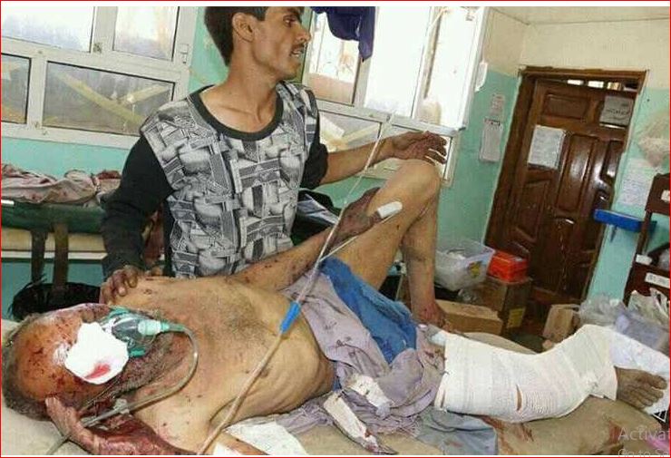 منظمات حقوقية ترحب بتحقيق دولي بجرائم العدوان في اليمن