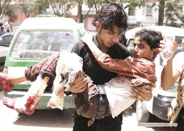 منظمة حقوقية تكشف أعداداً صادمة لضحايا حرب اليمن
