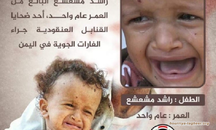 شاهد أصغر ضحايا القنابل العنقودية في اليمن