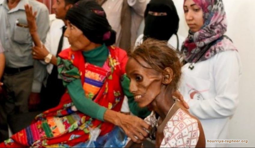 تقرير دولي يكشف حجم الكارثة وضحايا جرائم السعودية على اليمن