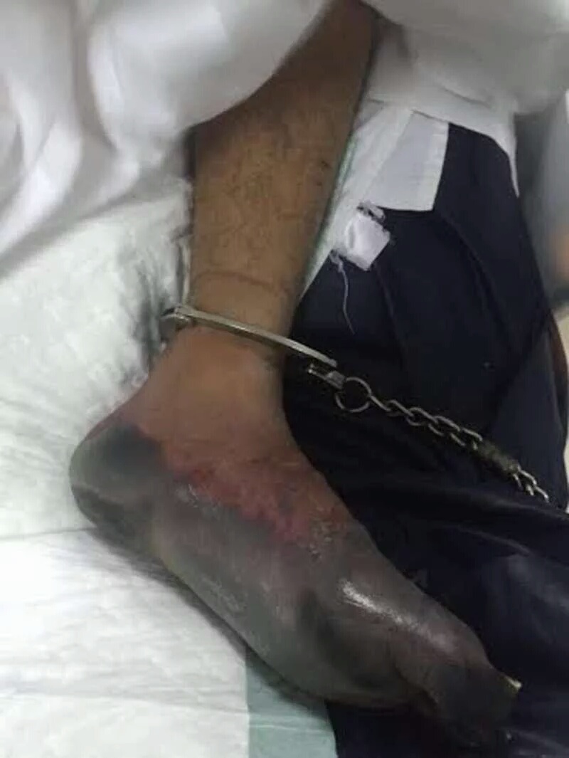 بالصور: معتقل في سجون مملكة آل سعود، يُنقل الى المستشفى جراء التعذيب الهمجي