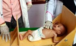 معهد أمريكي: اليمن كارثة آل سعود وسمعة ابن سلمان “مسممة”
