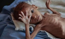 فيلم تركي قصير ومؤثر للغاية يجسد حال مجاعة ولوعة أطفال اليمن