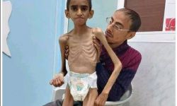 مرصد دولي: الحرب تدفع 20 مليون يمني نحو الفقر المدقع