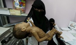 لجنة الإنقاذ الدولية : خطة المساعدات الإنسانية “السعودية” في اليمن تكتيك حرب
